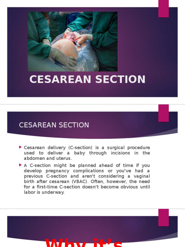 An In-Depth Look at Cesarean Sections: Explaining the Procedure ...