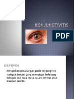 Konjungtivitis Sso