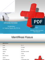 Epistaksis Posterior Fix