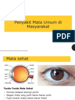 4 - Eye Disease