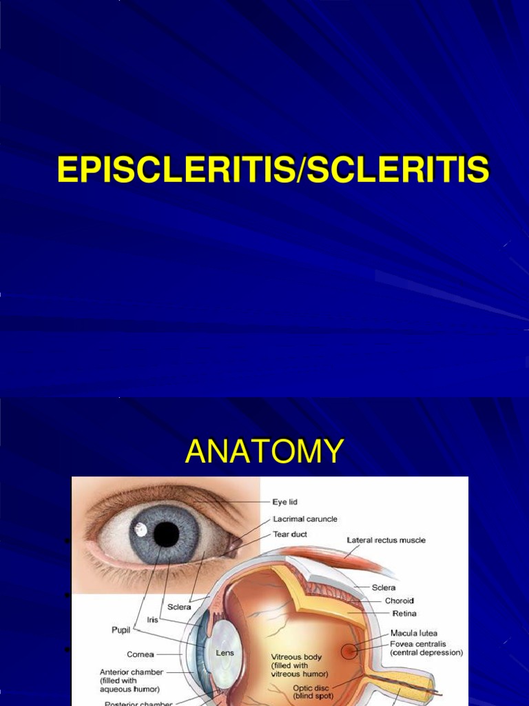 Episkleritis Pdf | Mengenal Episkleritis, Ketika Mata Mengalami ...