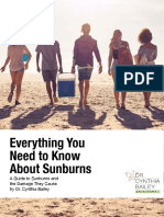 Everything You Need To Know About Sunburn