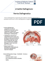 Malformatii de Esofag