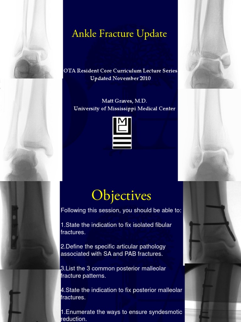 Ankle Fractures | PDF | Ankle | Limbs (Anatomy)