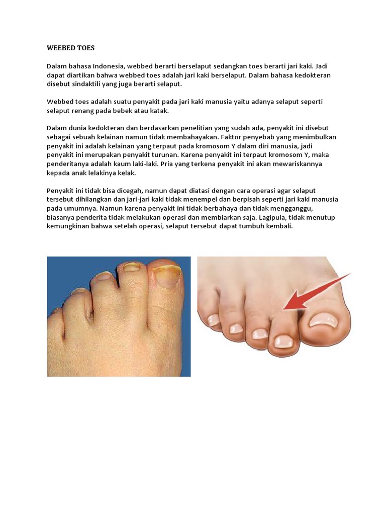 Weebed Toes Pdf