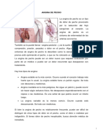 Angina de pecho: causas, síntomas y tipos