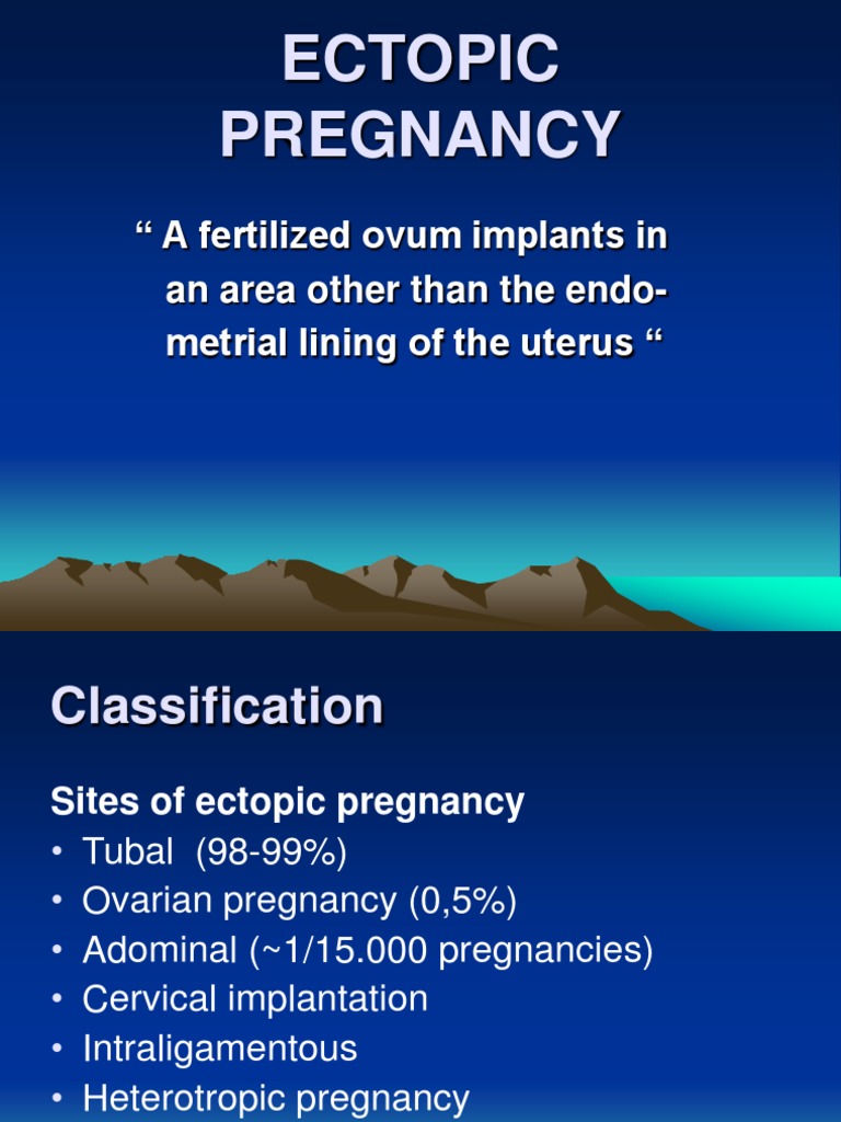 Ectopic Pregnancy | PDF | Gynaecology | Public Health