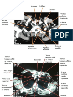 radiología de torax