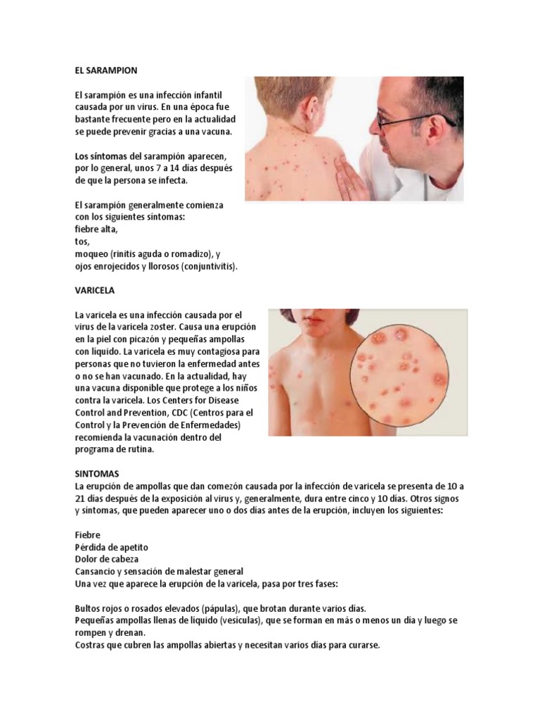 El Sarampion Pdf Sarampión Diarrea