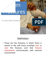 Open Fractures: DR Jaka Sefta Perdana