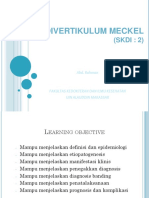 Divertikulum Meckel