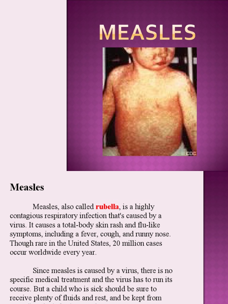 Measles | PDF | Measles | Infection
