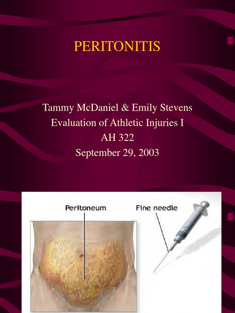 Peritonitis: Tammy Mcdaniel & Emily Stevens Evaluation of Athletic ...
