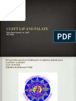 Cleft Lip and Palate