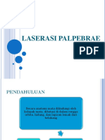 Referat Laserasi Palpebra