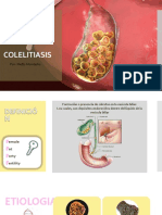 Semiología de La Colelitiasis