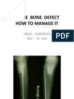 Large Bone Defect. DR Ismail