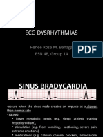 Ecg Dysrhythmias: Renee Rose M. Bañaga BSN 4B, Group 14