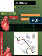 Diagramas Arritmias