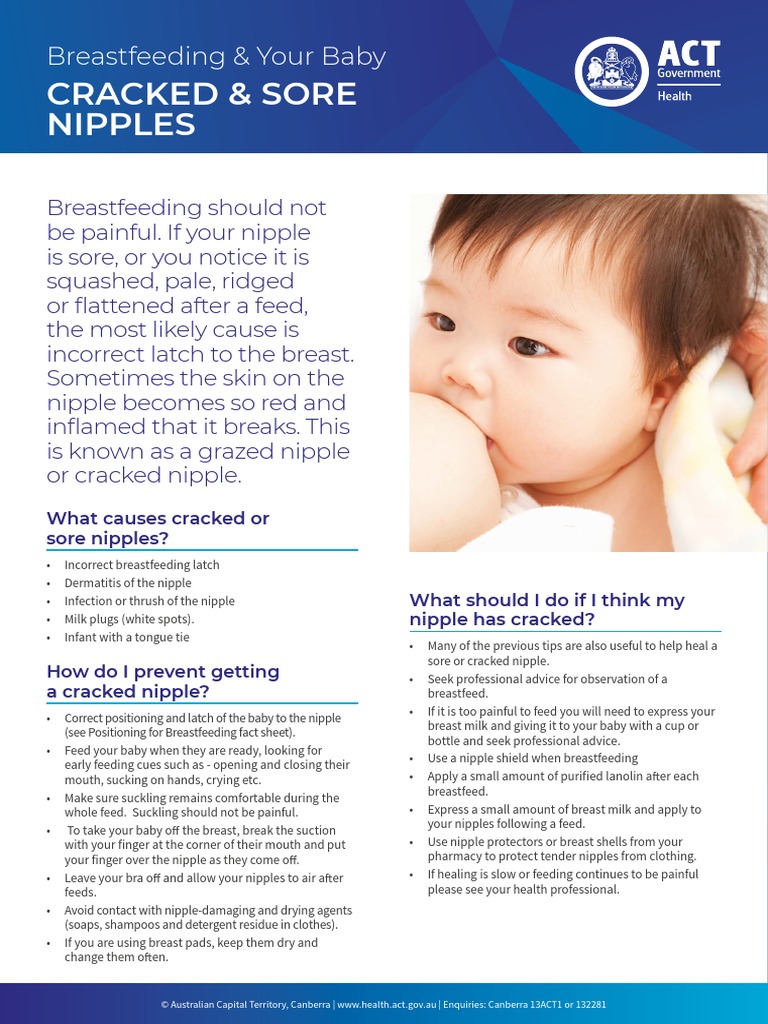 ACT H Cracked Nipples FactSheet 2018v1 PDF PDF Nipple Breastfeeding
