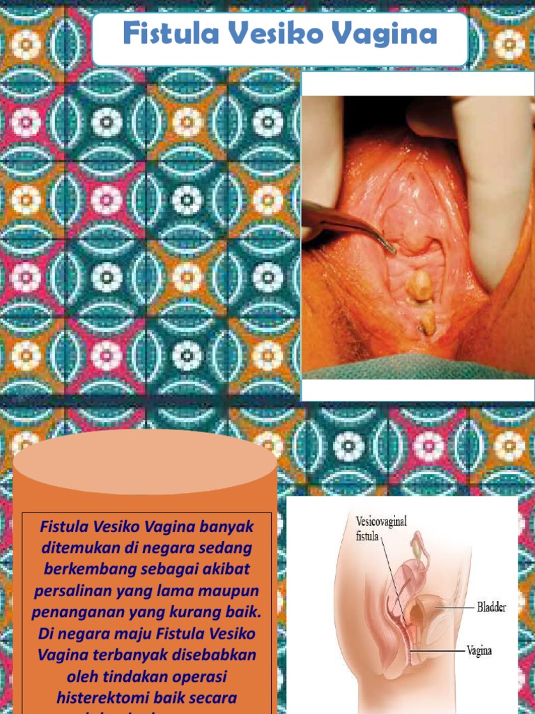 Juda semiz ayollar bilan ogzaki jinsiy aloqa