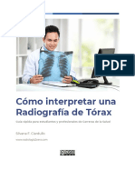 Cómo Interpretar Una Radiografía de Tórax