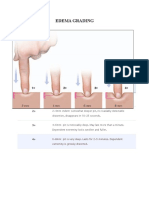 Edema Grading: Grade 1+