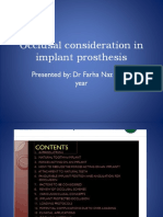 Occlusal Consideration in Implant Prosthesis