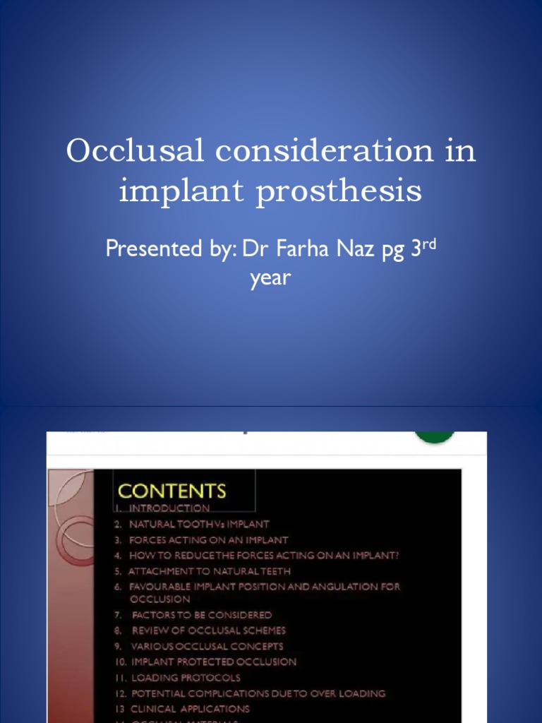 Occlusal Considerations for Implants | PDF | Dental Implant | Dental ...
