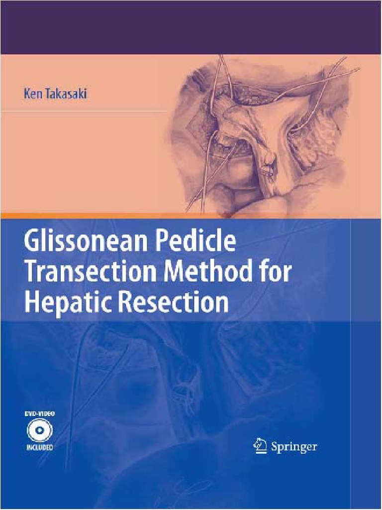 Glissonean Pedicle Transection Method For Hepatic Resection | PDF ...