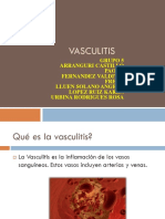 Vasculitis