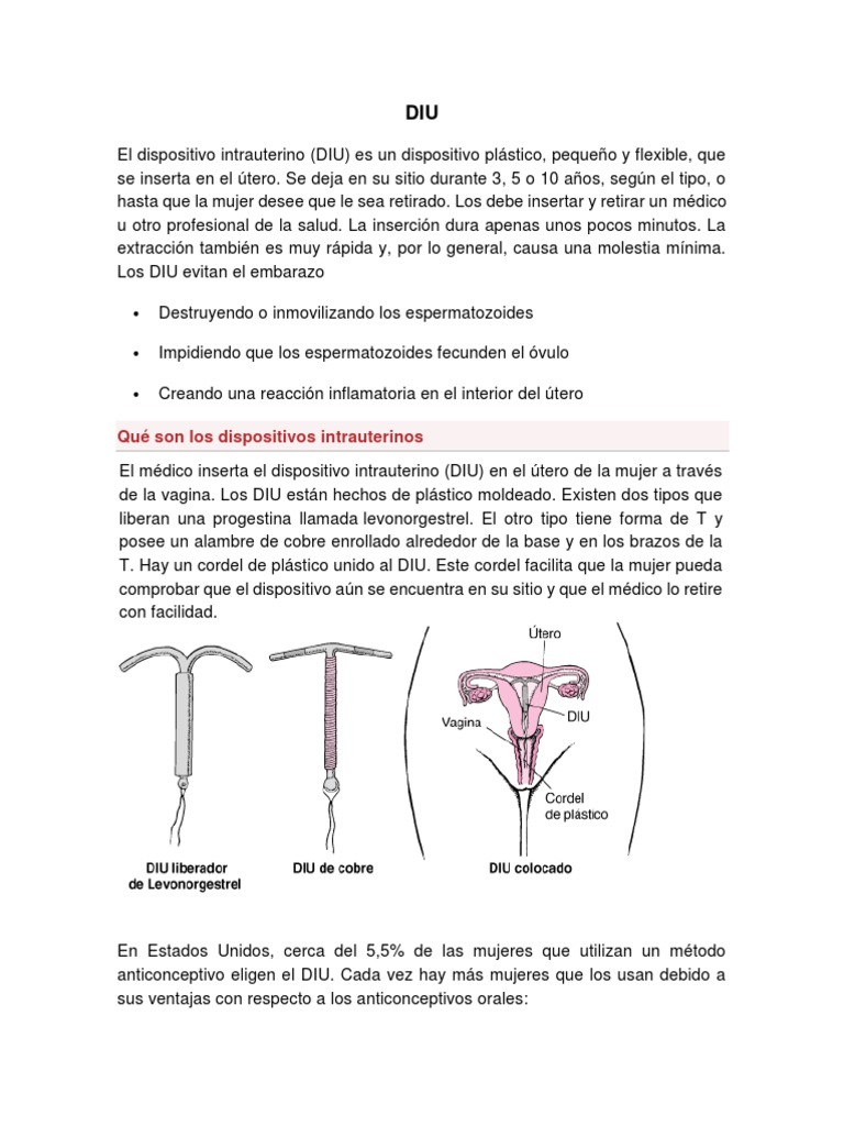 Guía sobre el Dispositivo Intrauterino (DIU) | PDF | Control de la ...