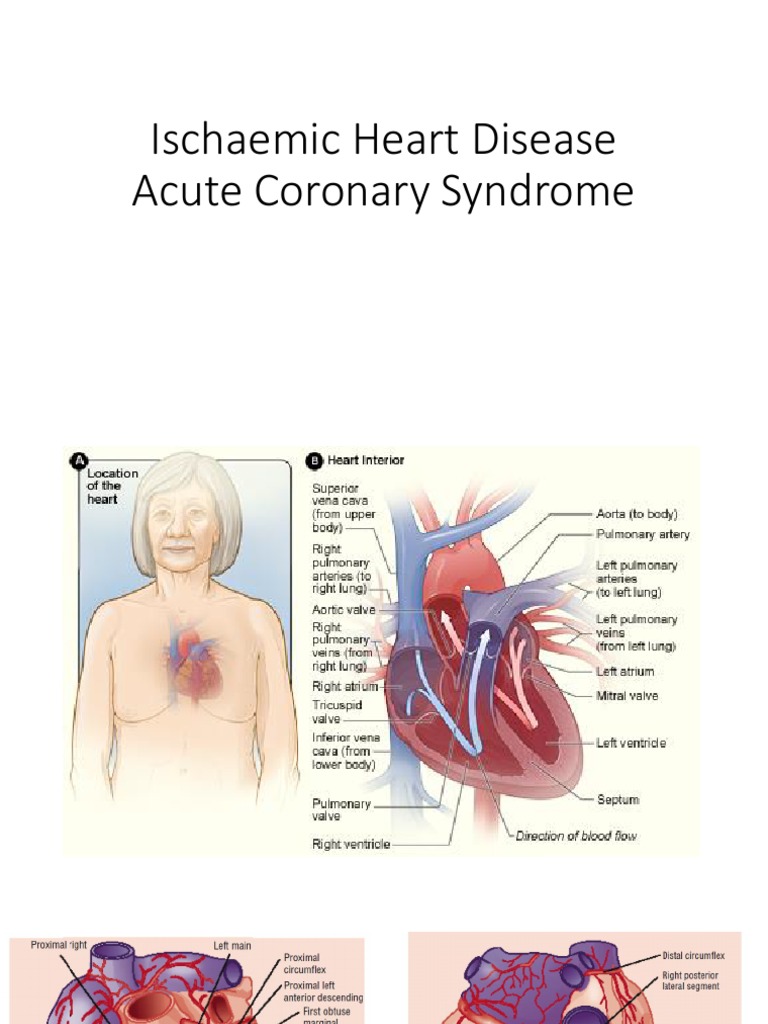 Ischemia intelligence overview
