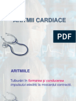 Aritmii Cardiace