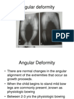 Angular Deformity