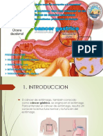 Cancer Gastrico