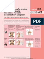 Lumbar Transforaminal Epidural Steroid Injection: Needle Localization Diagram