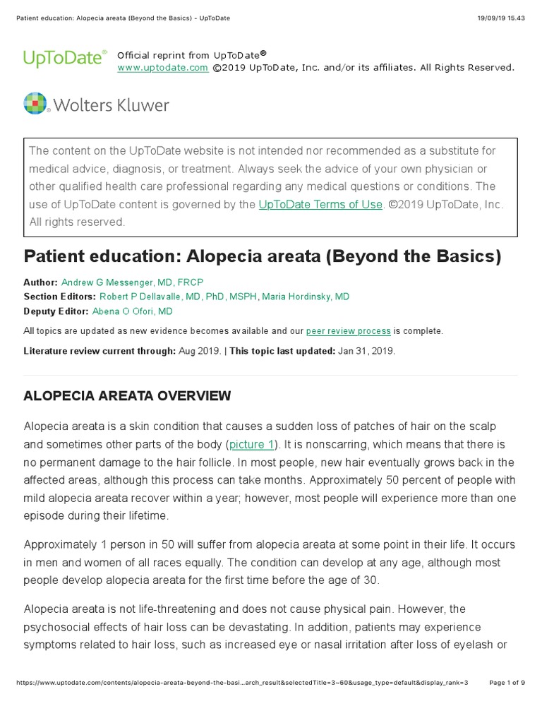 Patient Education Alopecia Areata (Beyond The Basics) UpToDate PDF