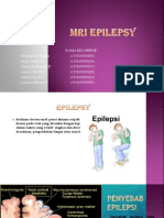 MRI Epilepsi