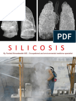 Silicossis