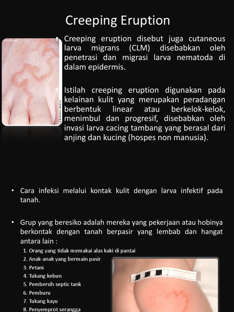 Creeping Eruption PDF