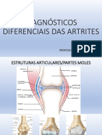 Diagnosticos diferenciais de Artrites