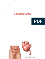 Apendicetomía.ppt