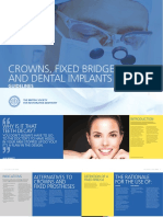 Crowns, Fixed Bridges and Dental Implants: Guidelines
