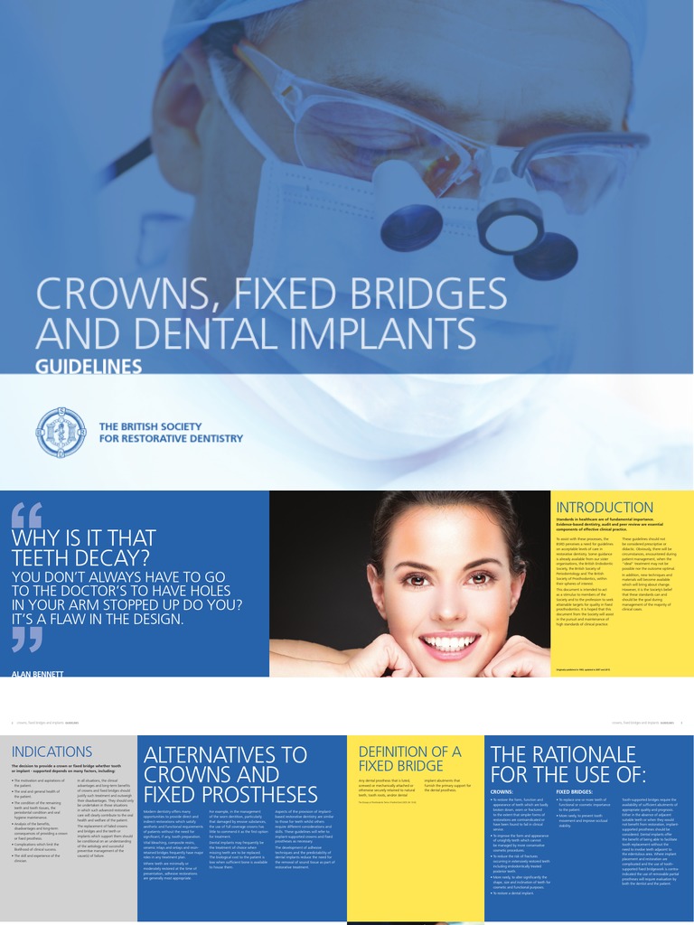 Crowns, Fixed Bridges and Dental Implants Guidelines PDF Dental Implant Human Tooth