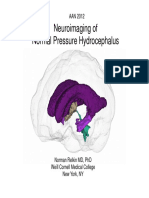 Neuroimaging of Normal Pressure Hydrocephalus