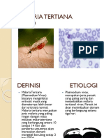 Malaria Tertiana