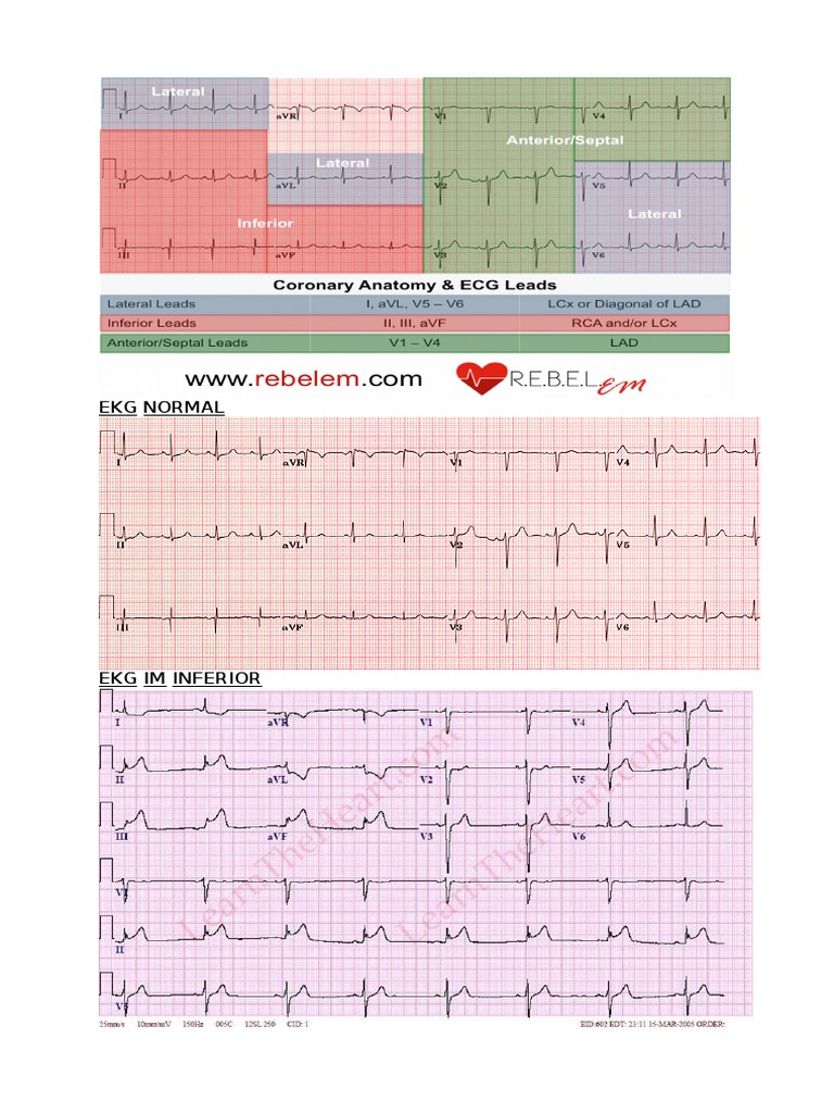 Ekg Normal | PDF