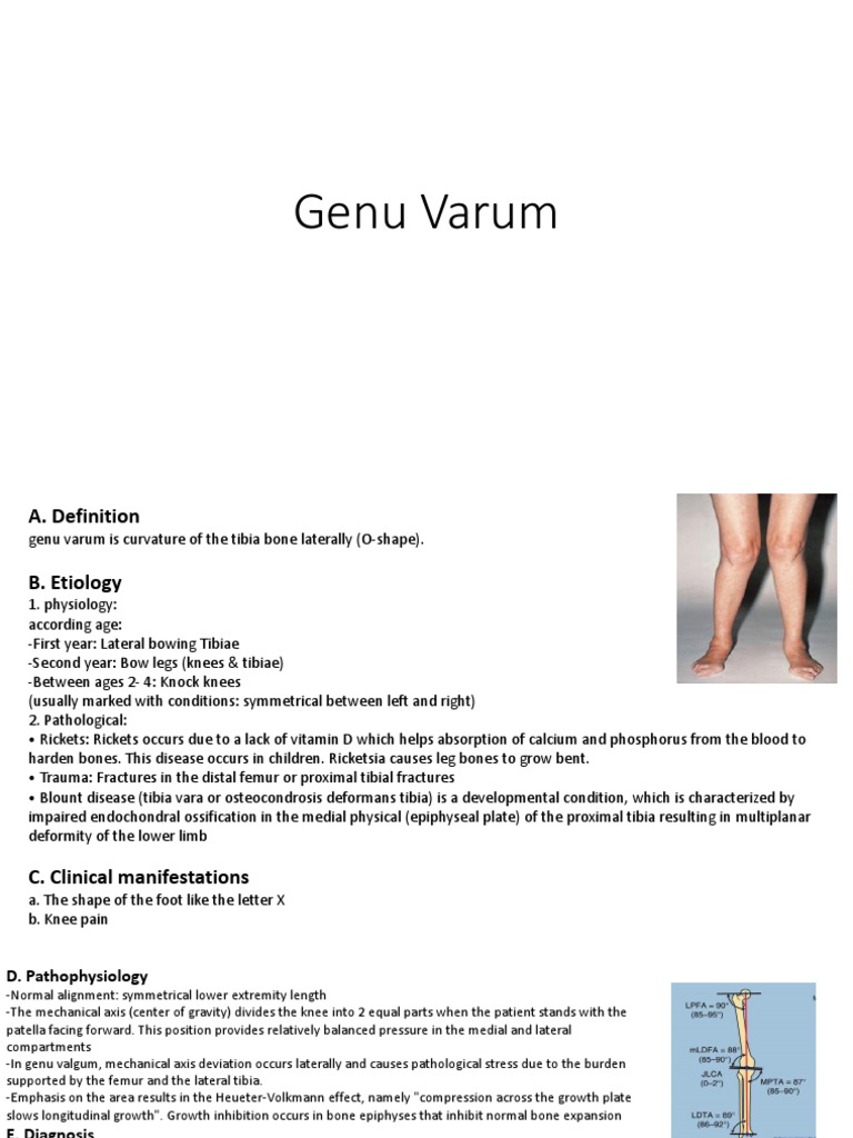 Genu Varum Knee Human Leg