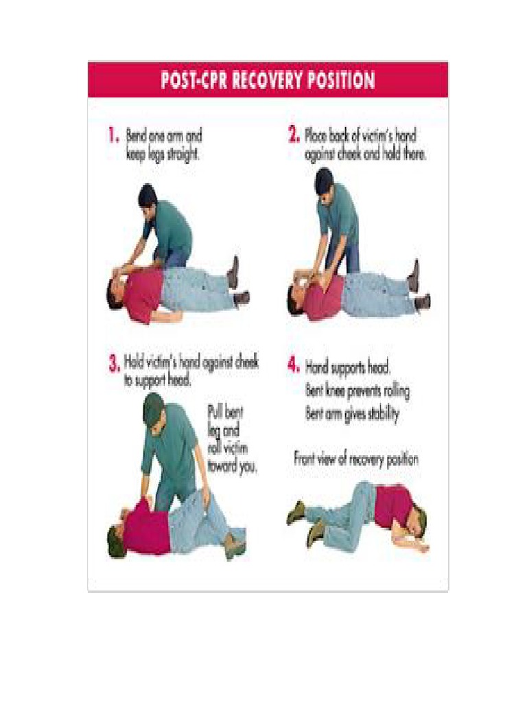 Gambar CPR 1 | PDF